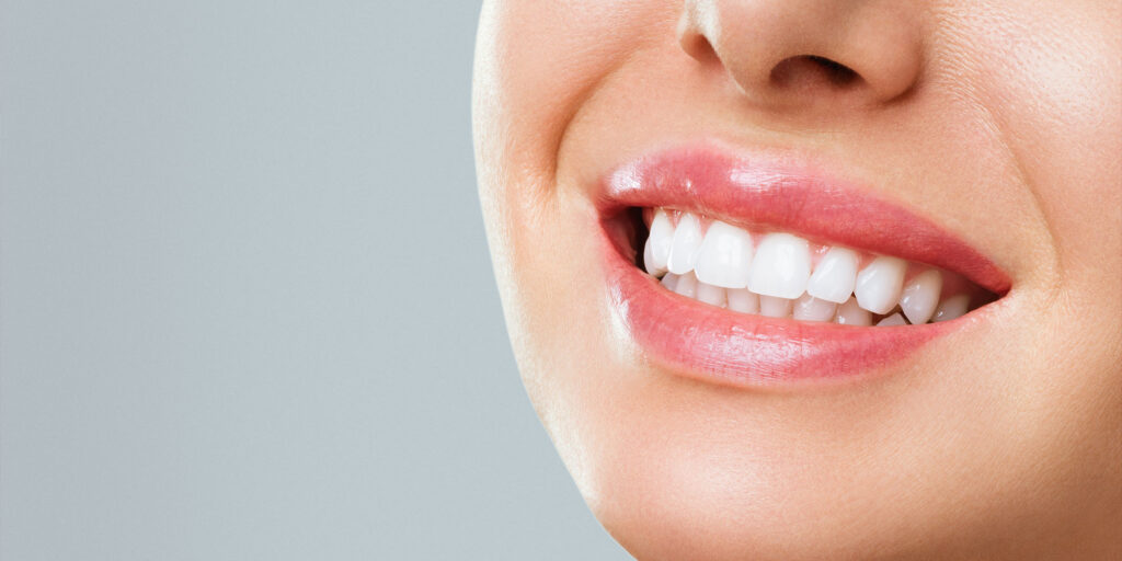 Woman showing off freathly whitened teeth