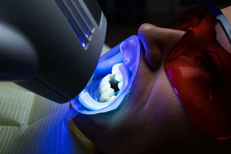 Woman getting her teeth whitened