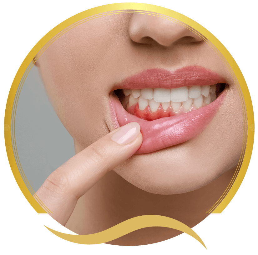 gum disease issues